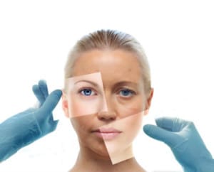 facial rejuvenation 300x242 1