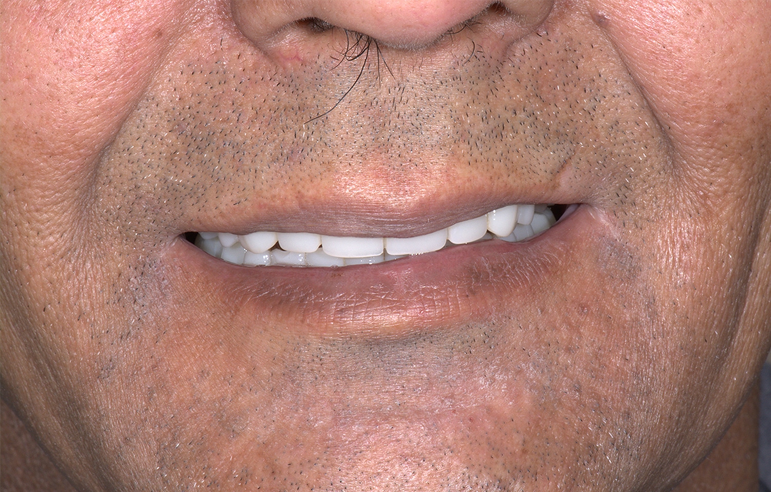 After Image: Oral Surgery - front