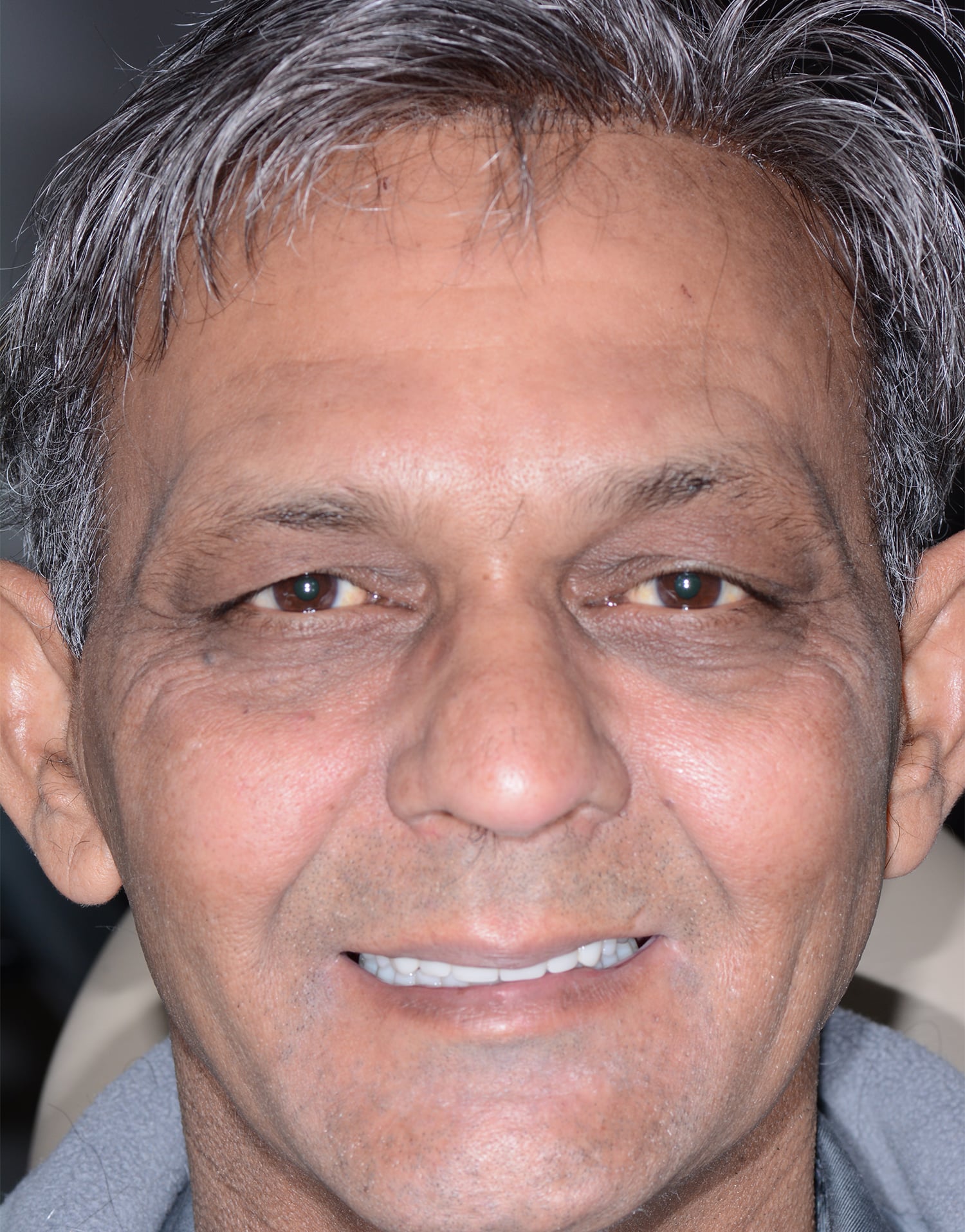 After Image: Oral Surgery - front