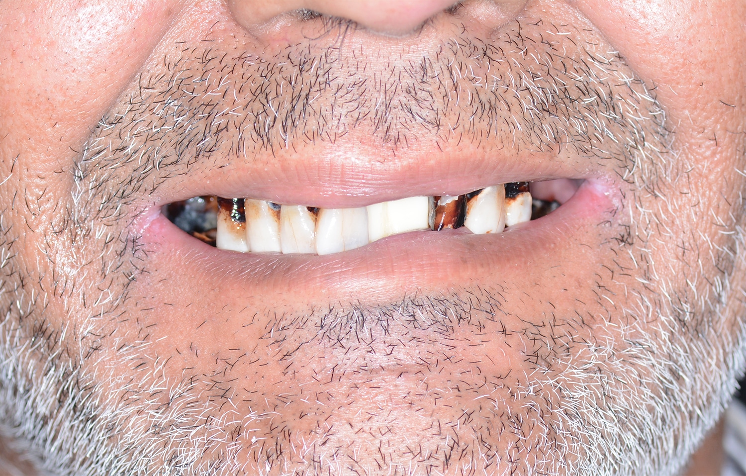 Before Image: Oral Surgery - front