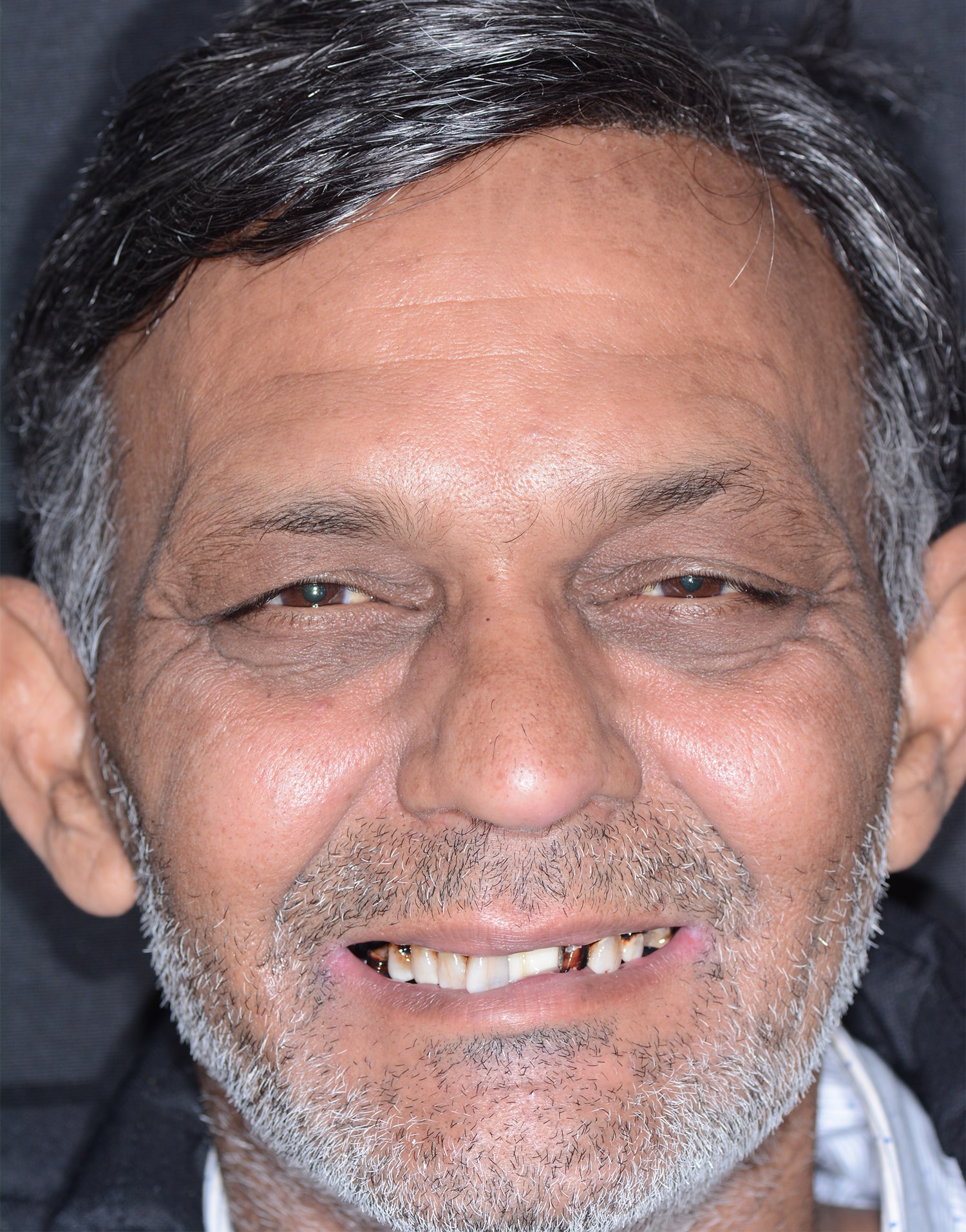 Before Image: Oral Surgery - front