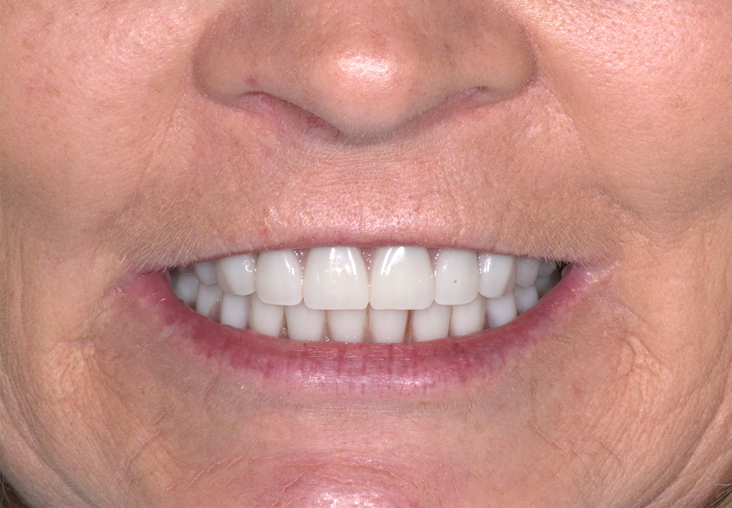 After Image: Oral Surgery - front