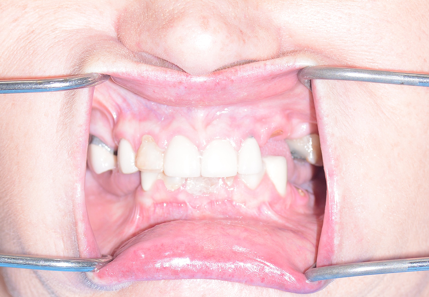 Before Image: Oral Surgery - front