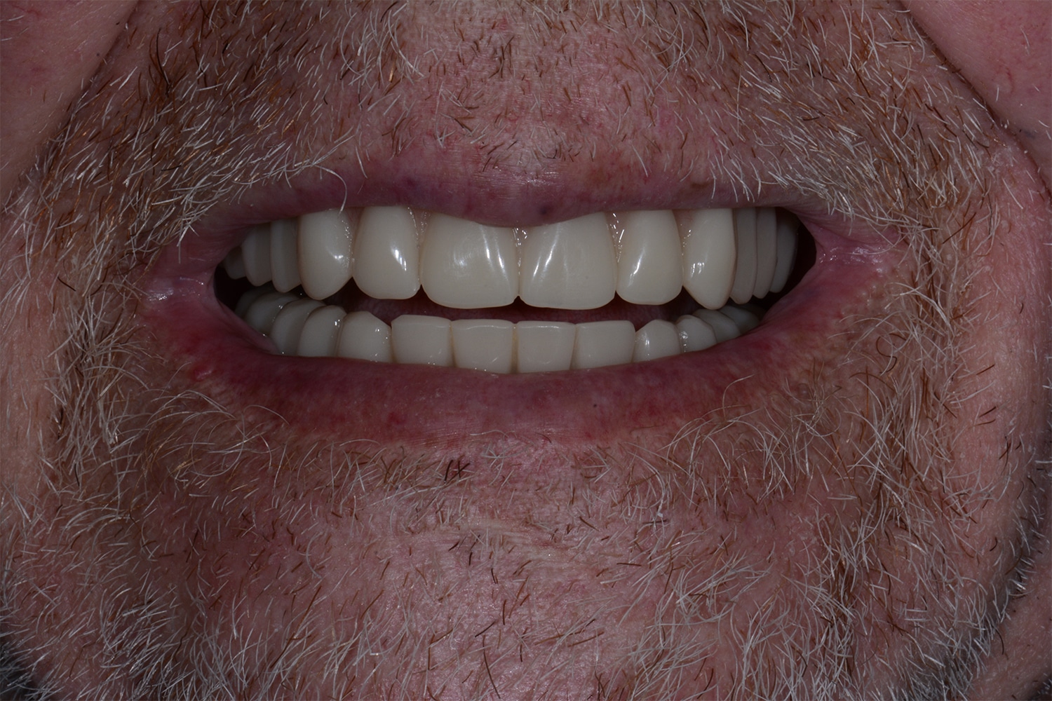 After Image: Oral Surgery - front