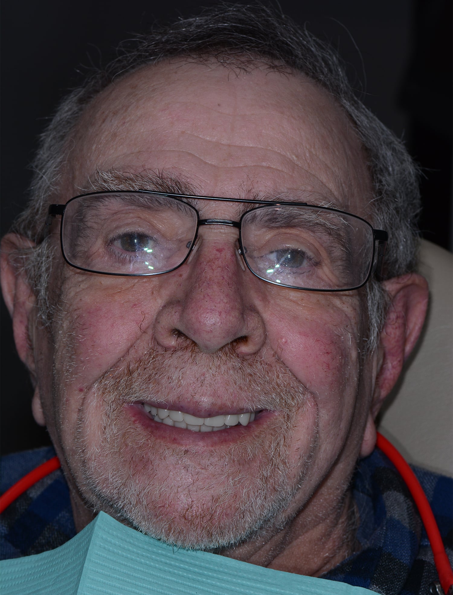 After Image: Oral Surgery - front