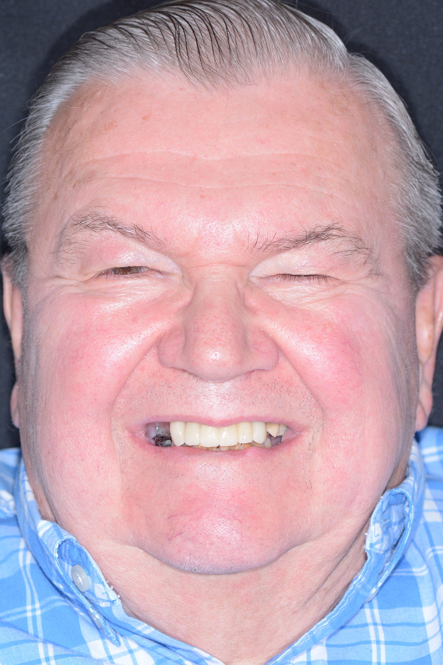 Before Image: Oral Surgery - front