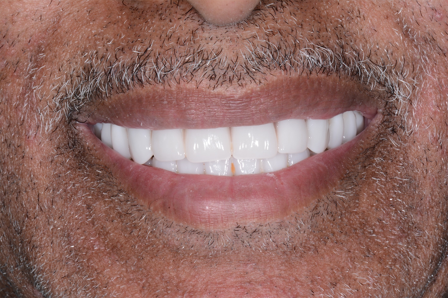 After Image: Oral Surgery - front