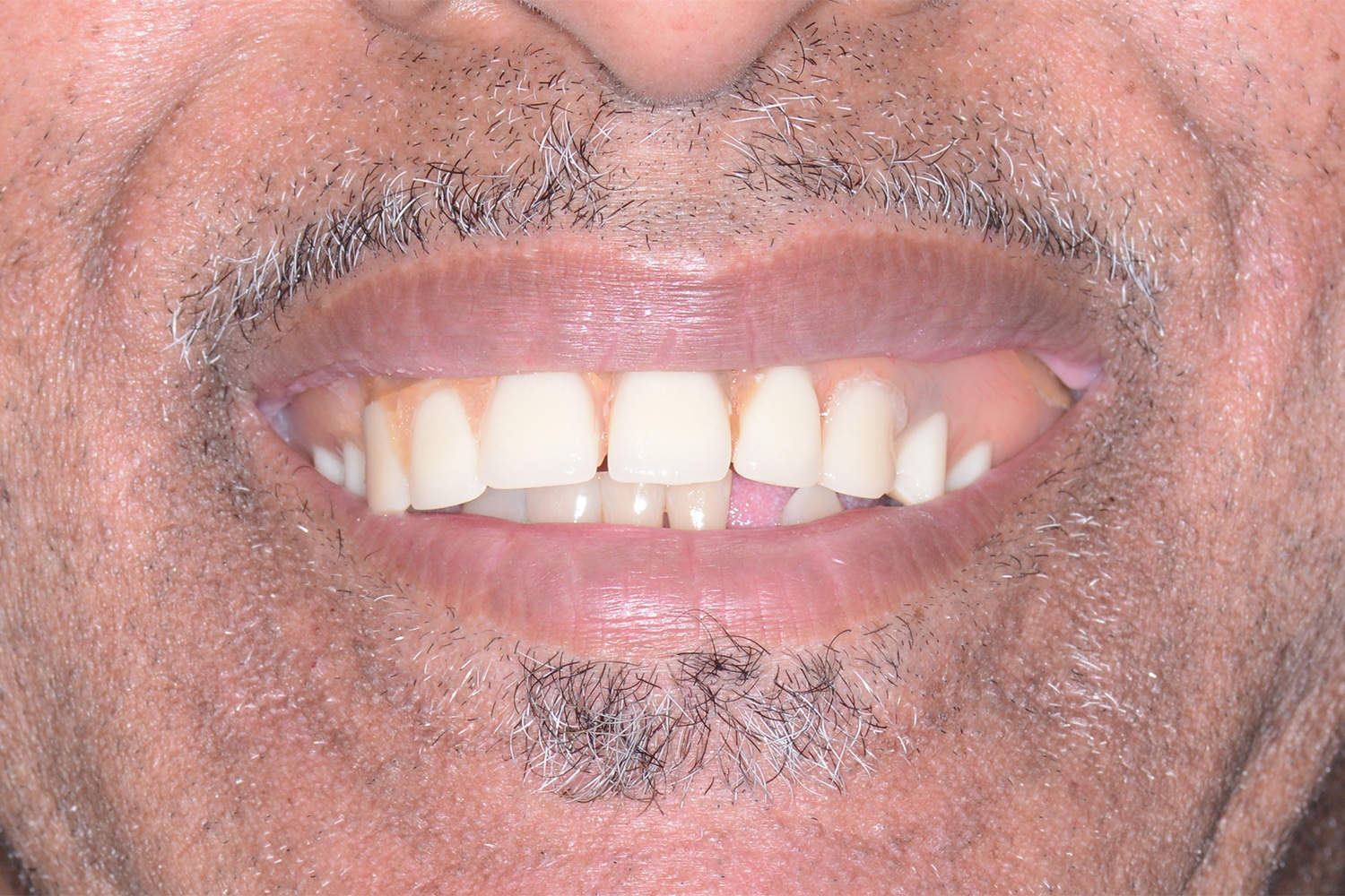 Before Image: Oral Surgery - front