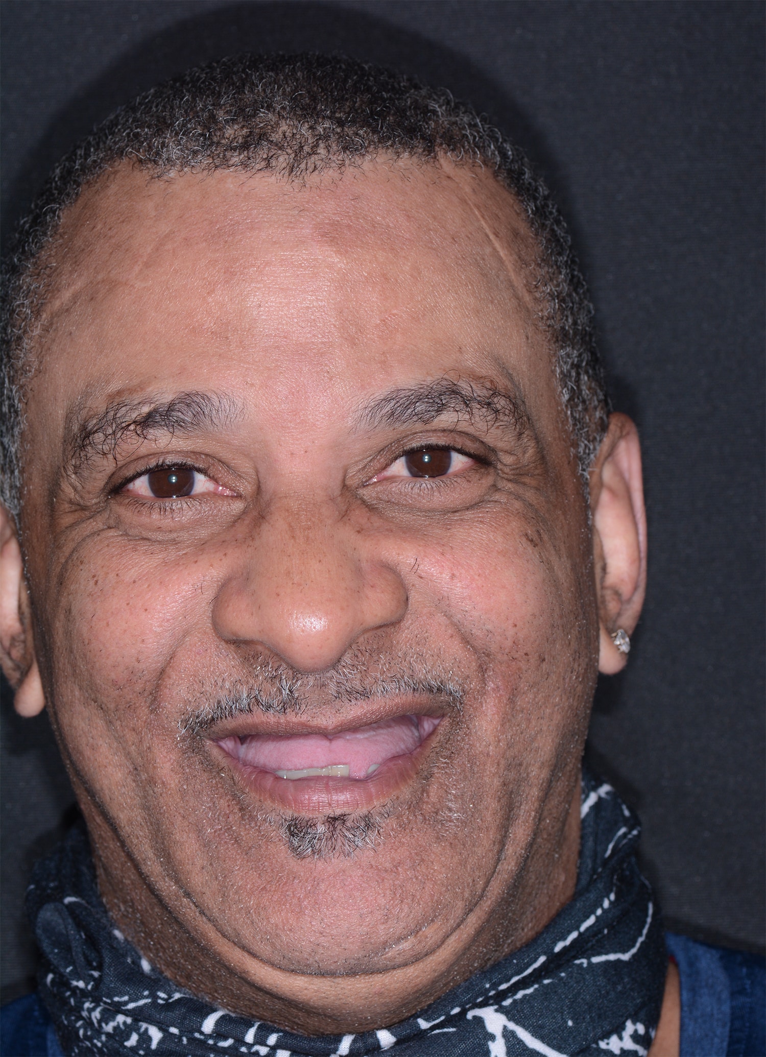 Before Image: Oral Surgery - front