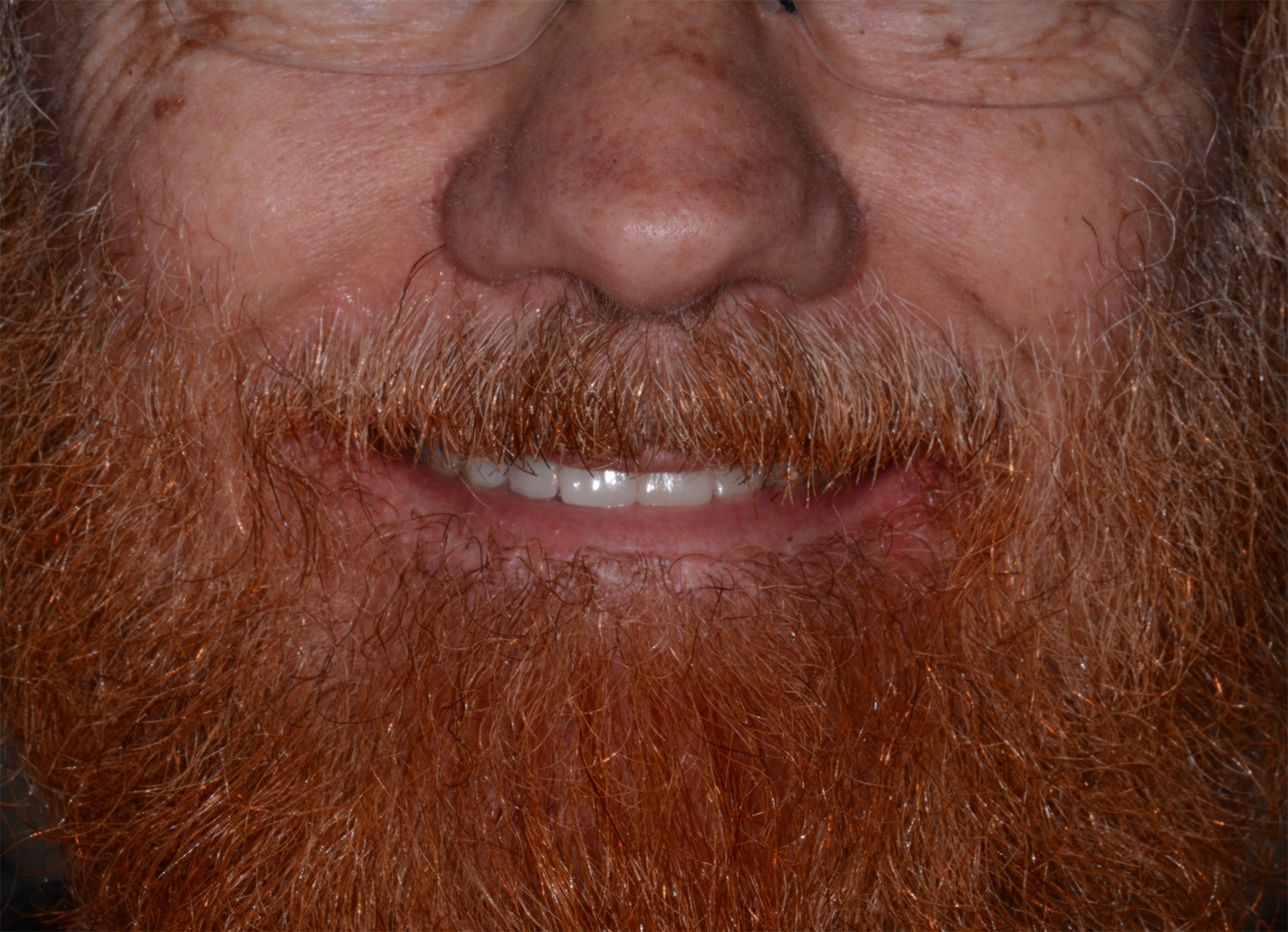 After Image: Oral Surgery - front