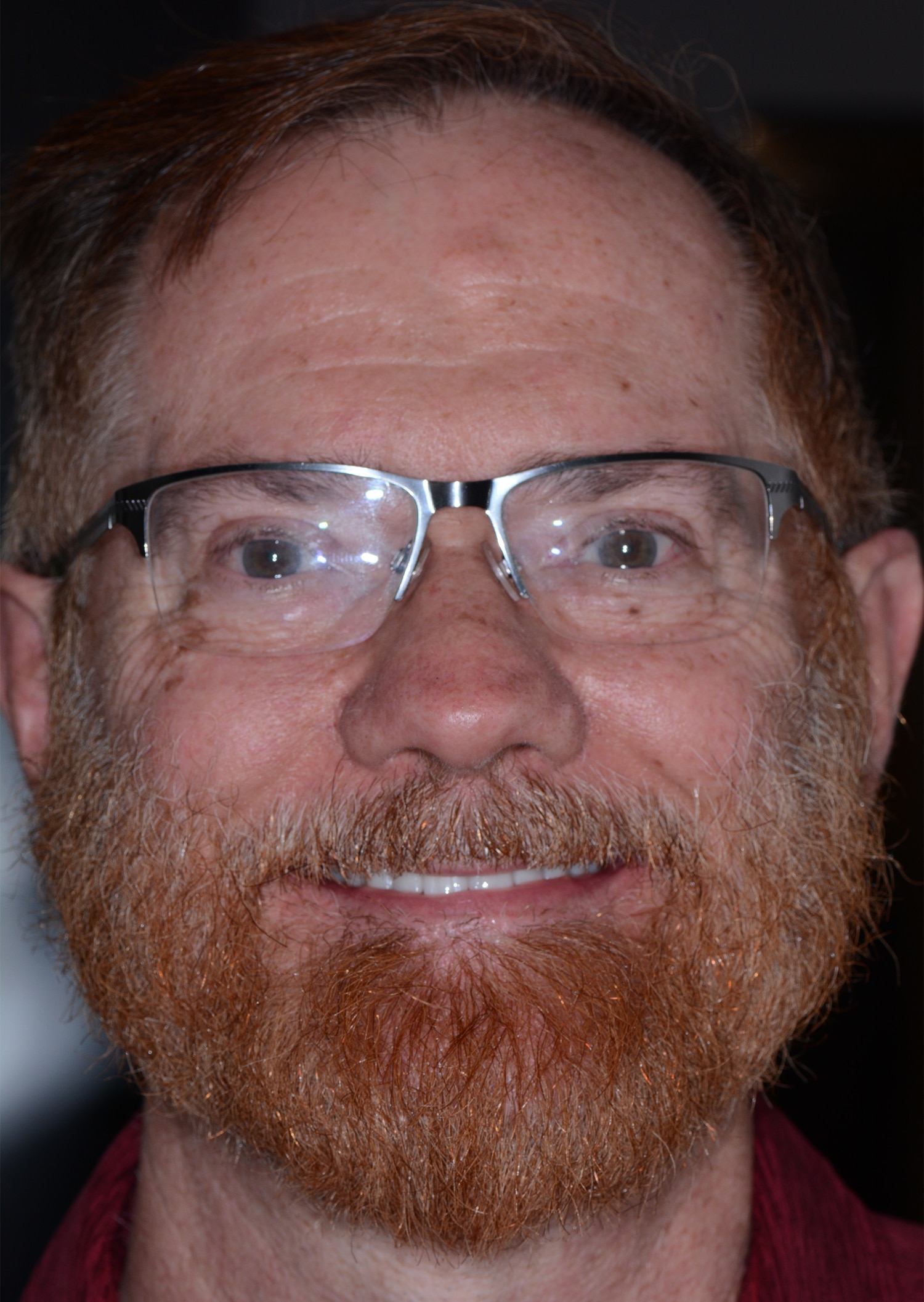 After Image: Oral Surgery - front