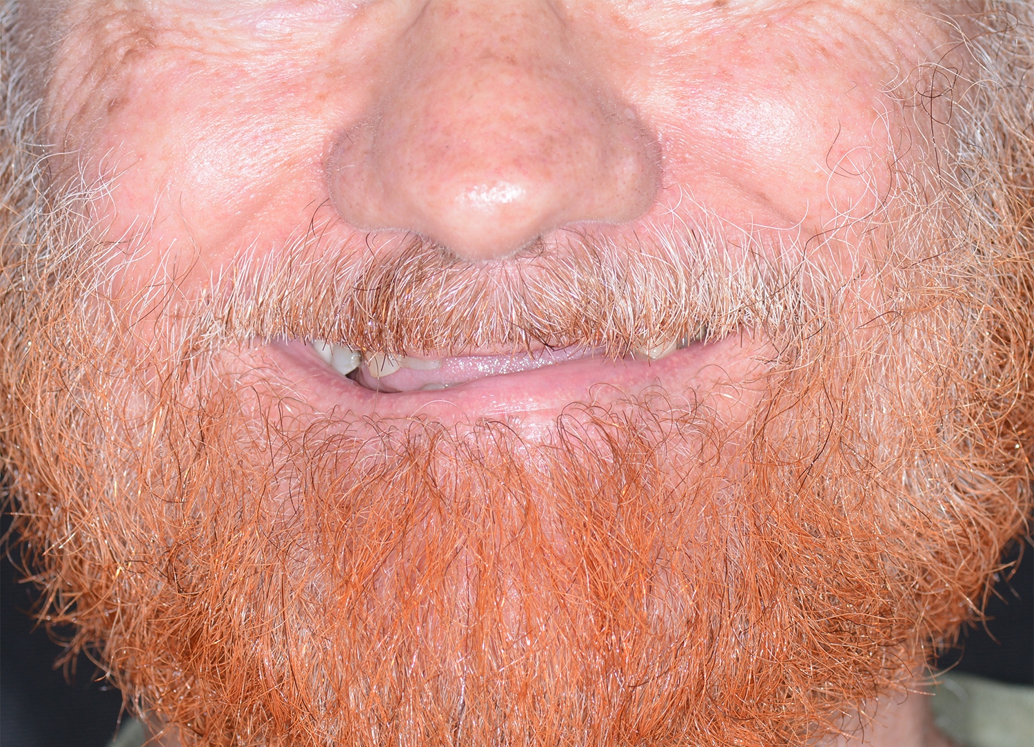 Before Image: Oral Surgery - front