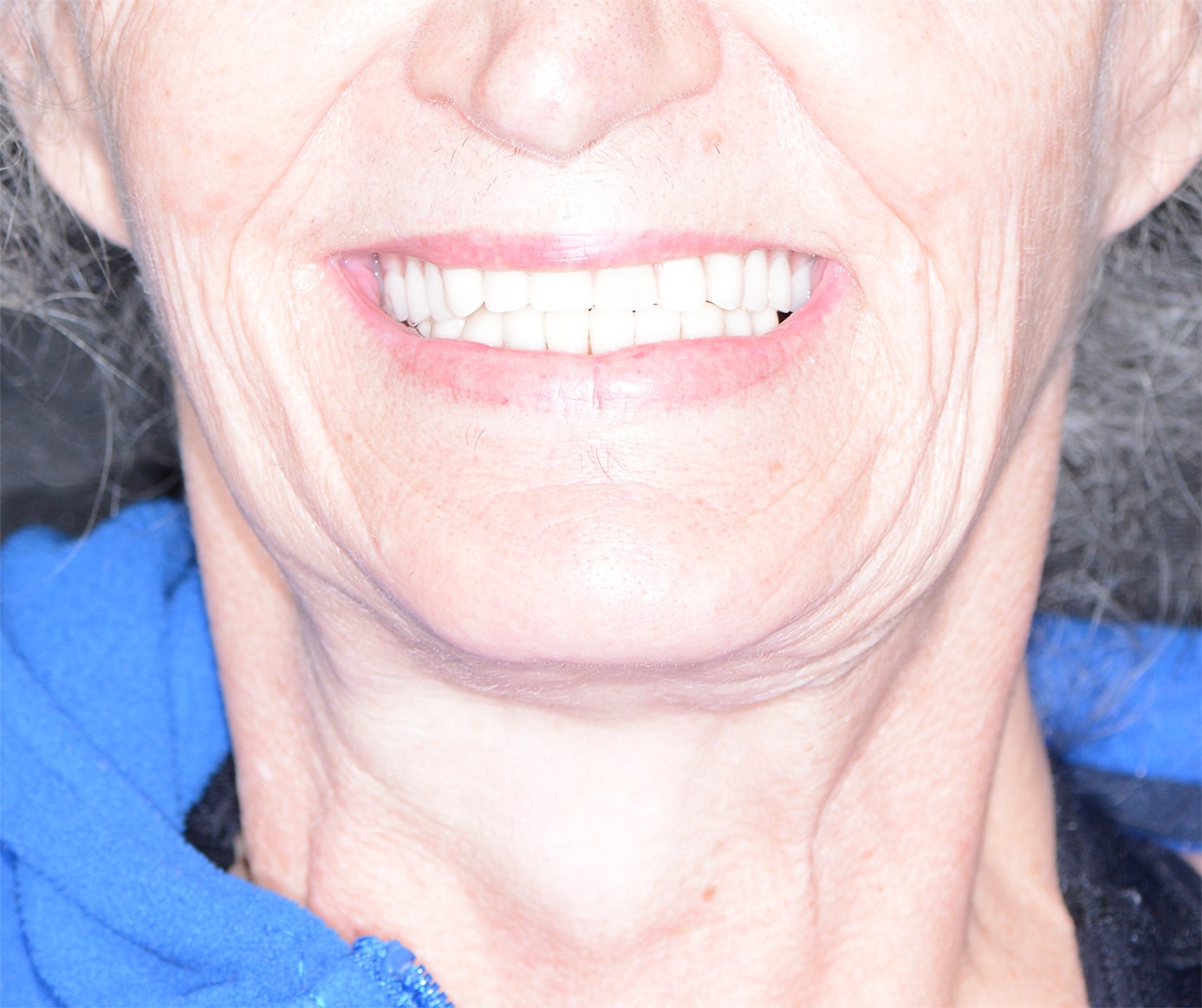 After Image: Oral Surgery - front