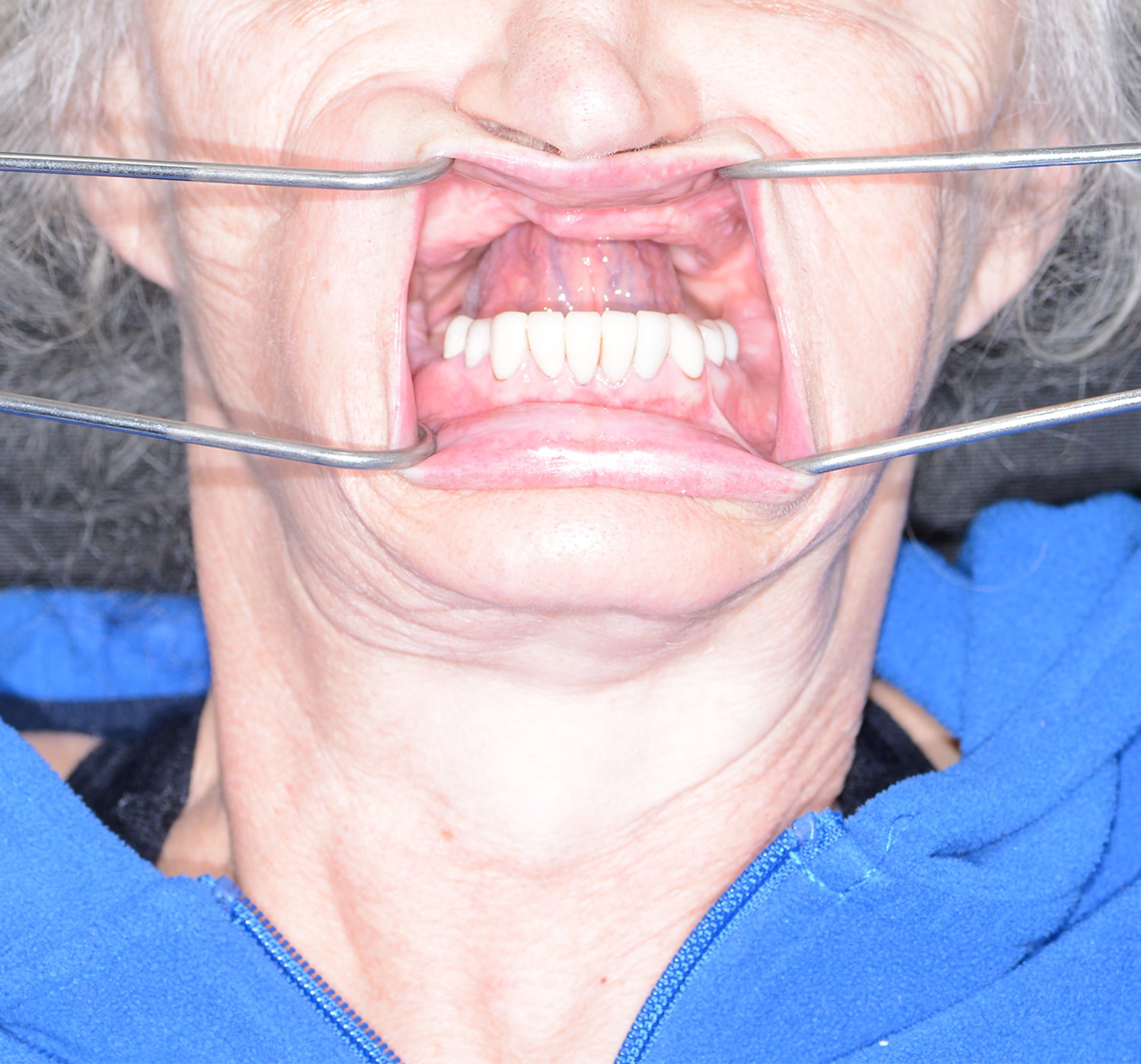 Before Image: Oral Surgery - front