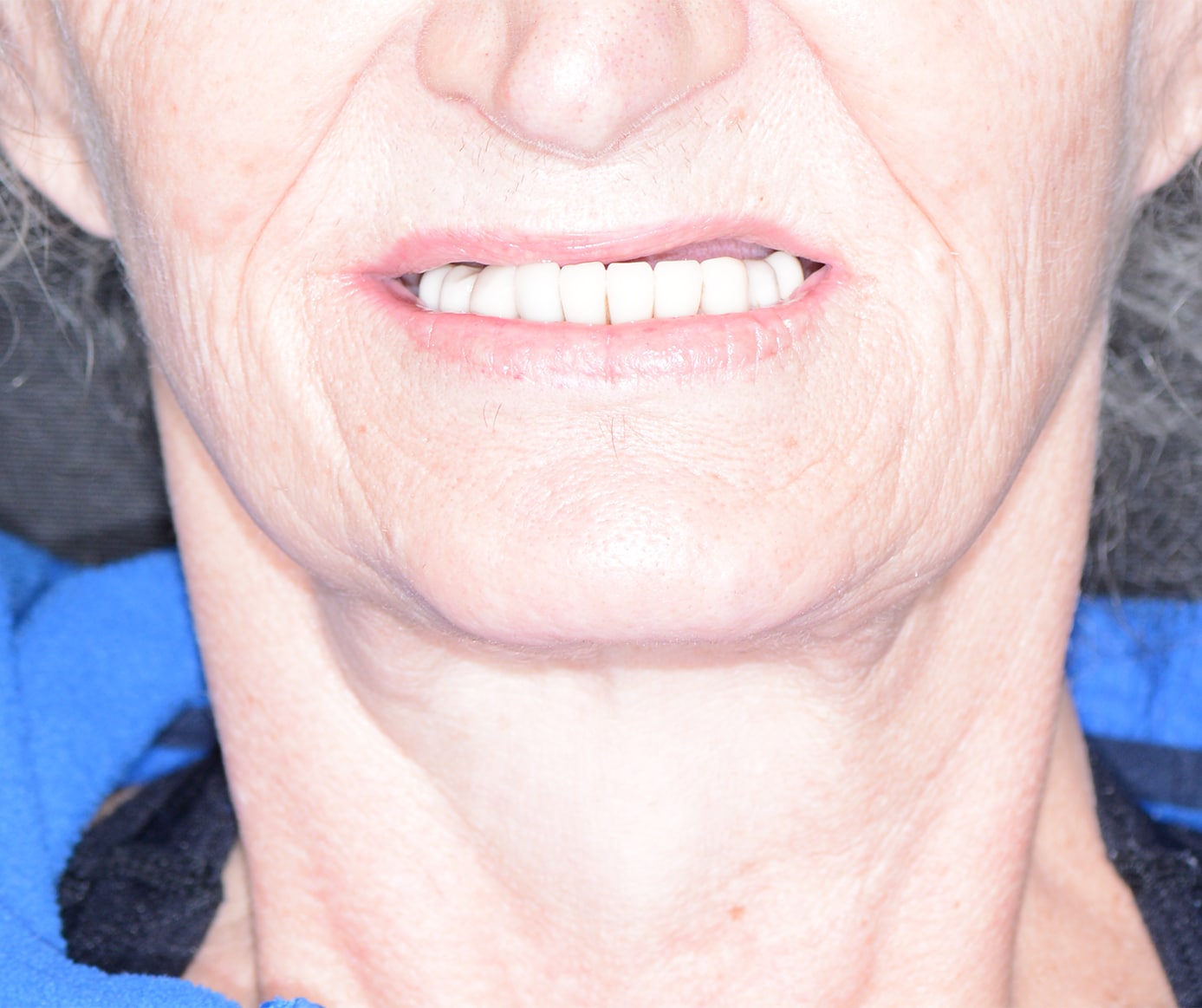 Before Image: Oral Surgery - front