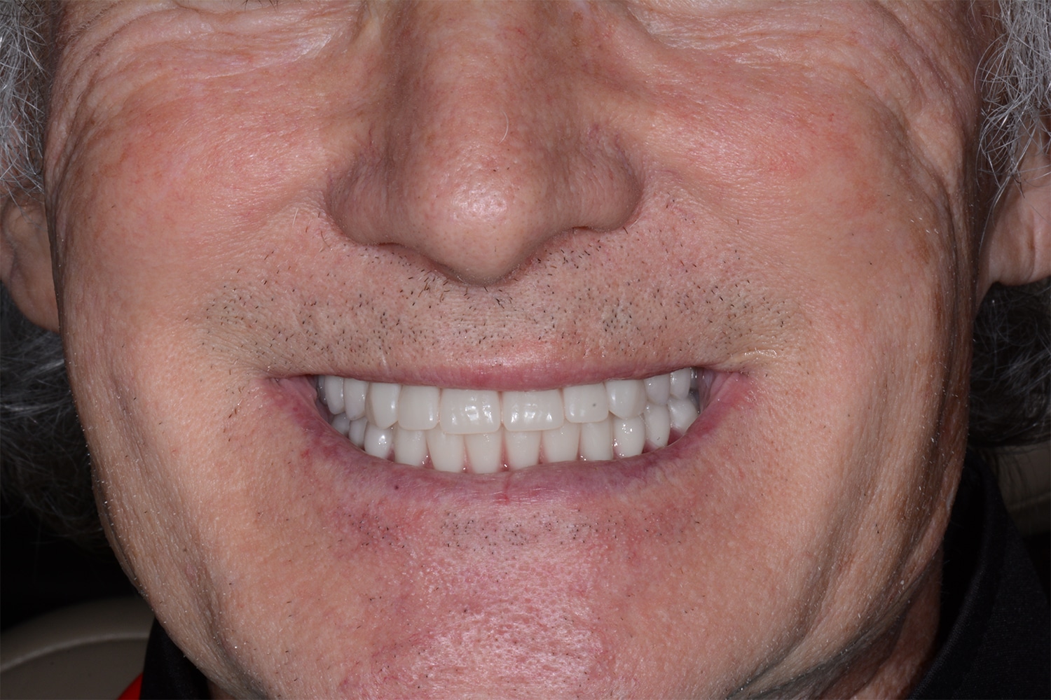 After Image: Oral Surgery - front