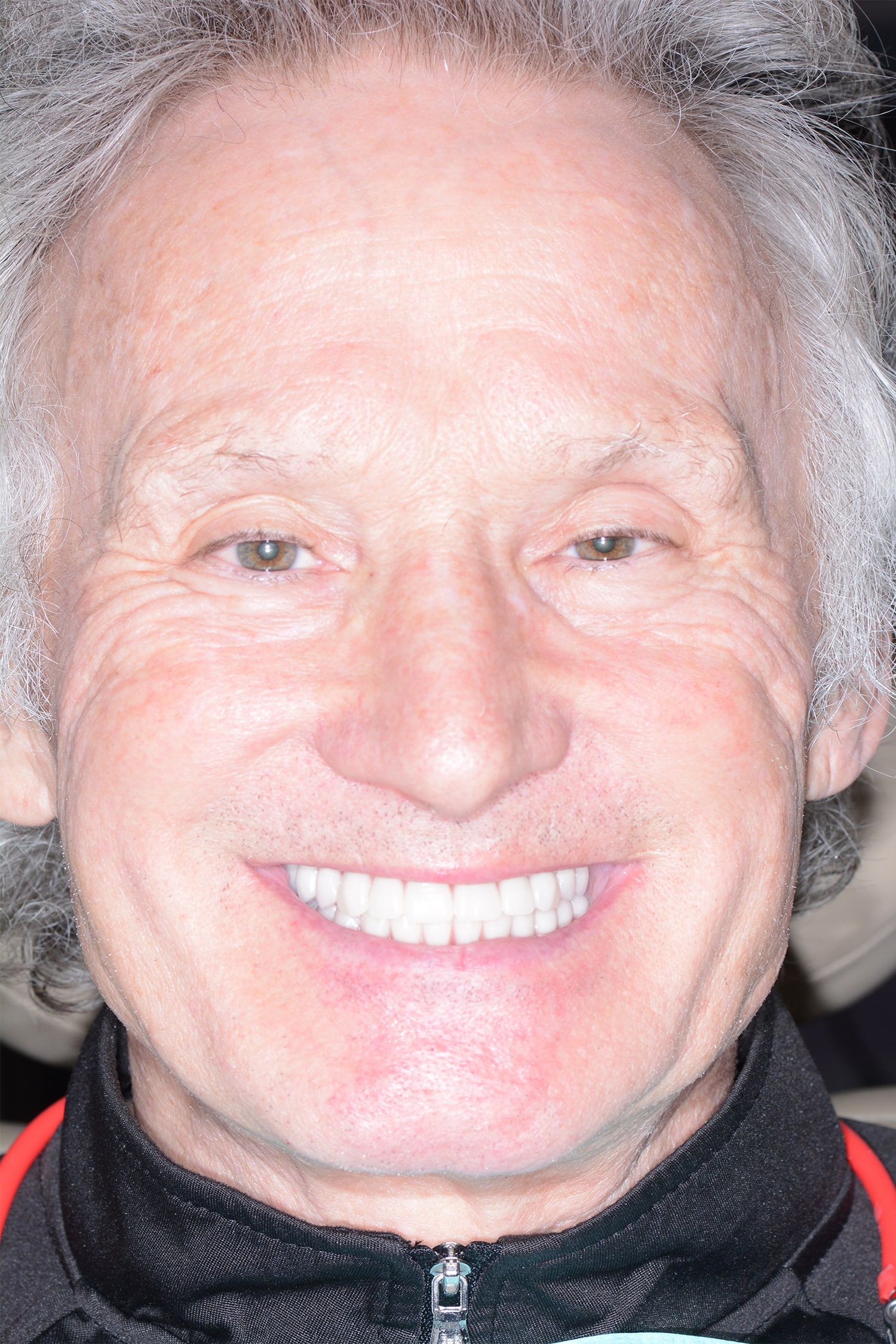 After Image: Oral Surgery - front