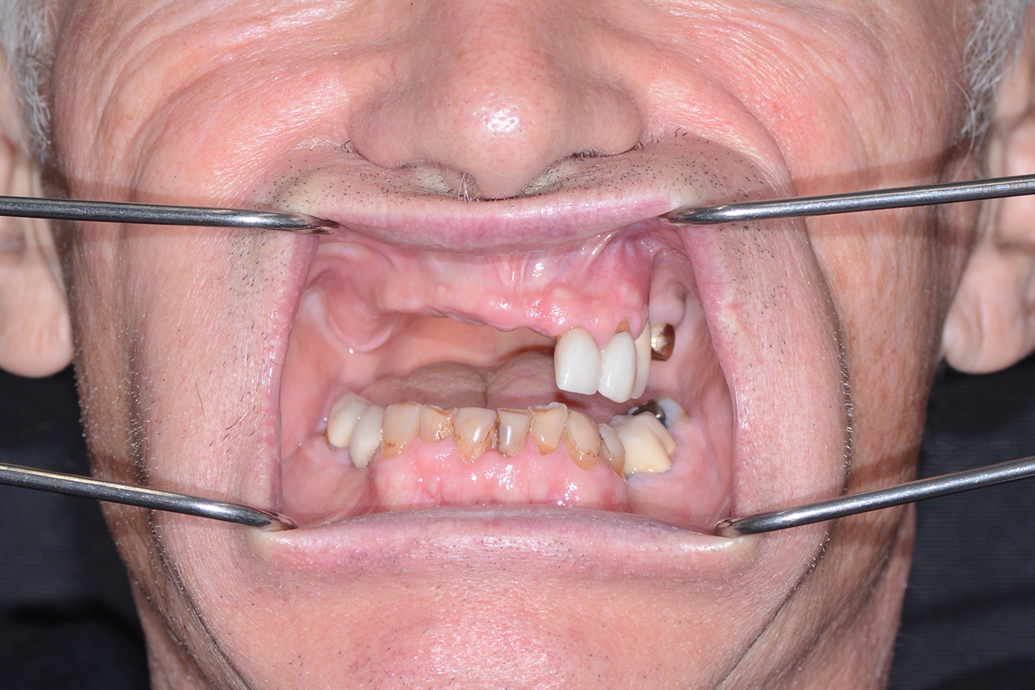 Before Image: Oral Surgery - front