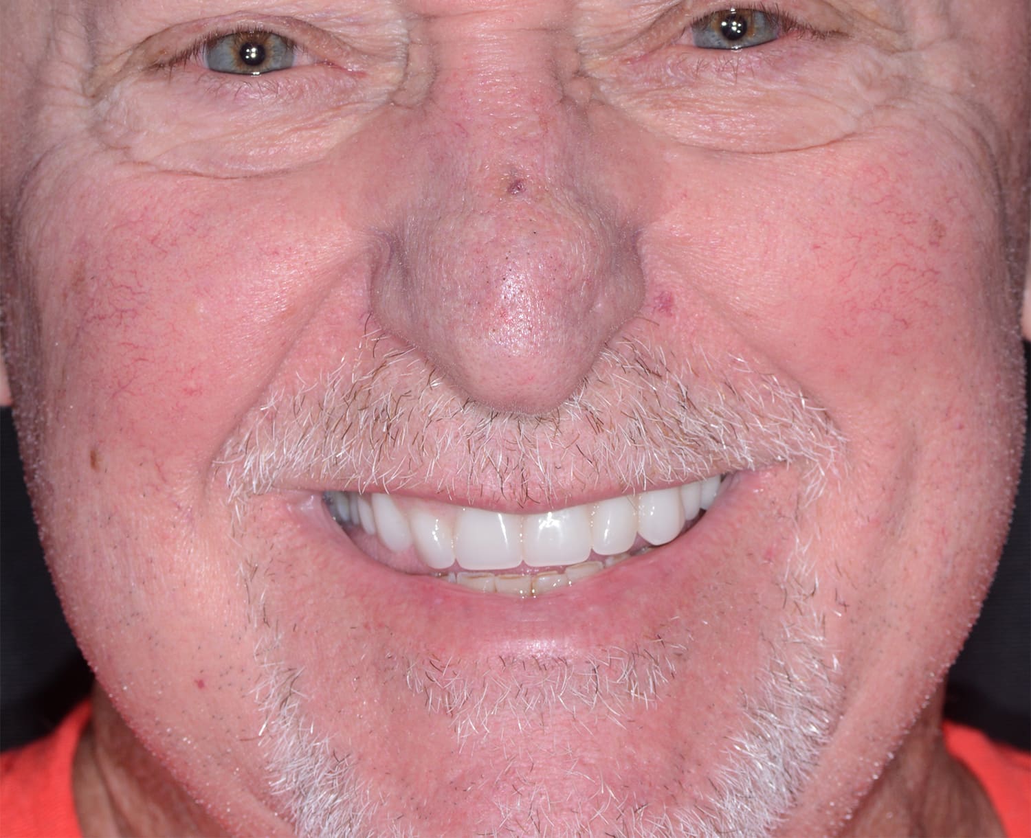 After Image: Oral Surgery - front