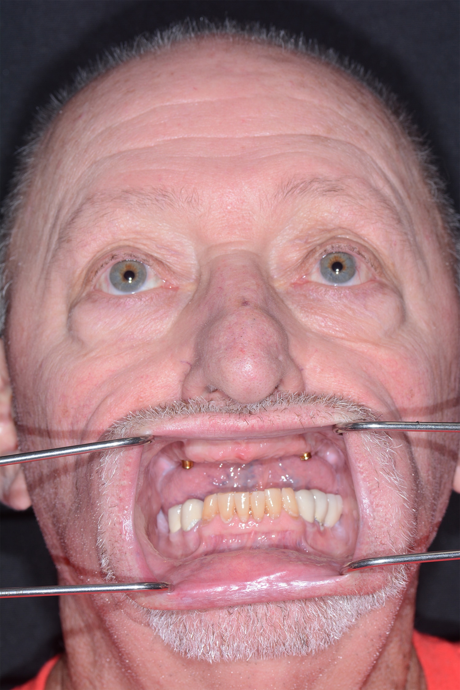 Before Image: Oral Surgery - front