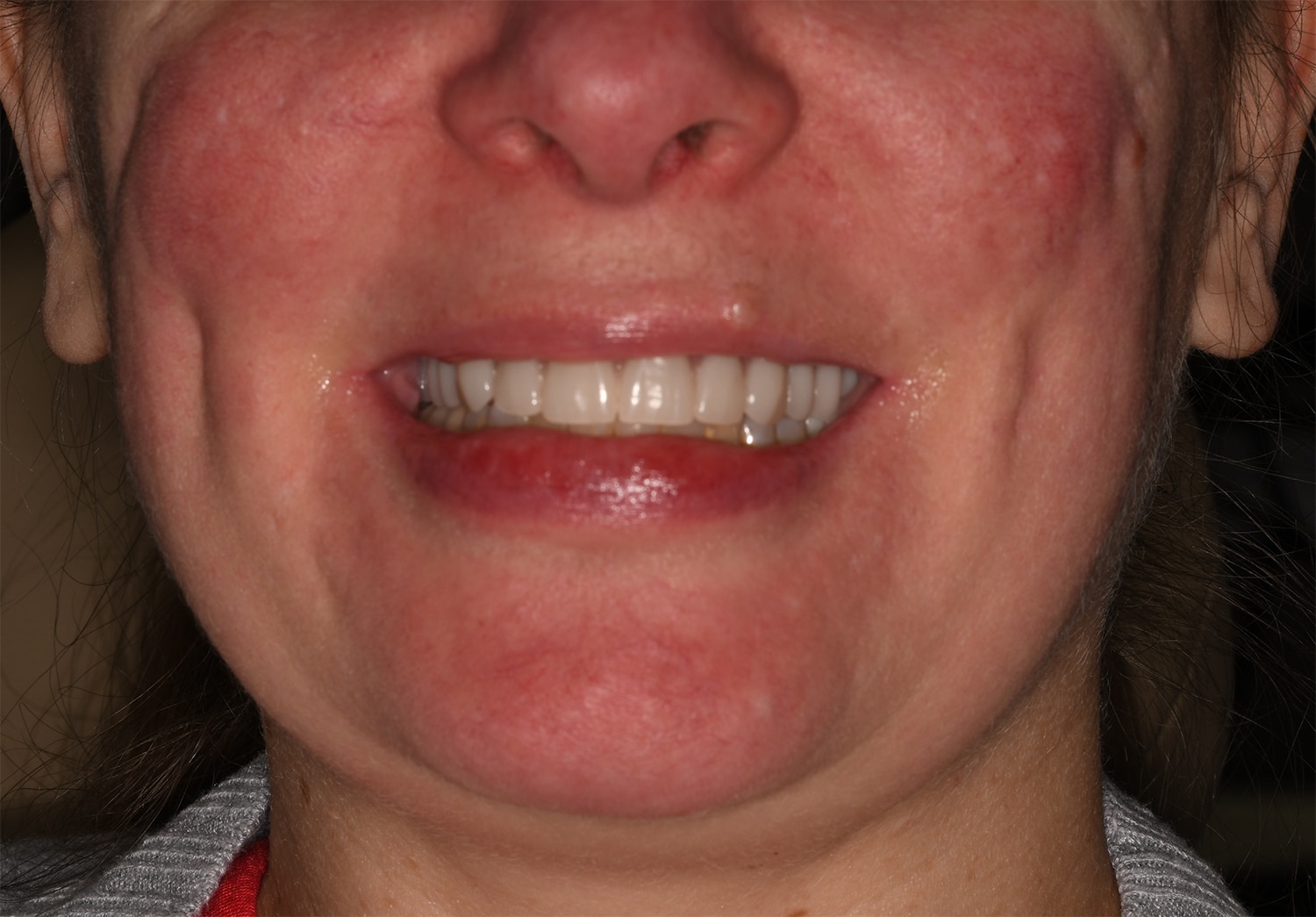 After Image: Oral Surgery - front