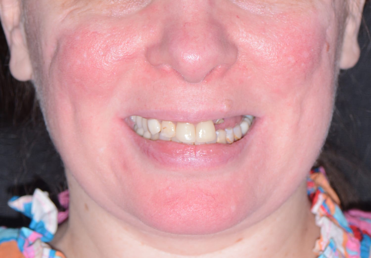 Before Image: Oral Surgery - front