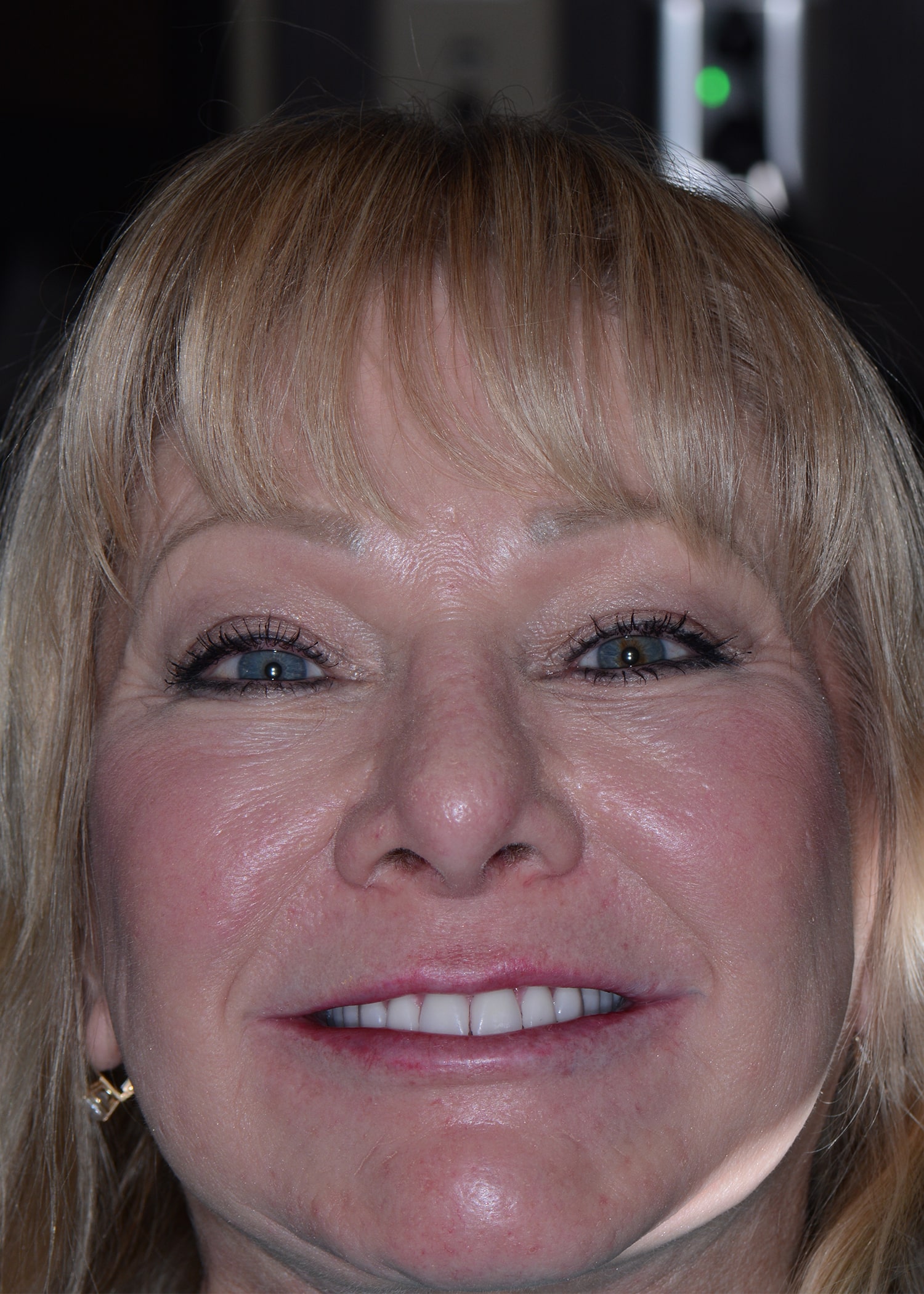 After Image: Oral Surgery - front